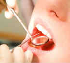 歯科診療のイメージ画像